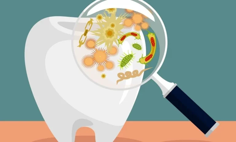 How long until a tooth infection kills you?