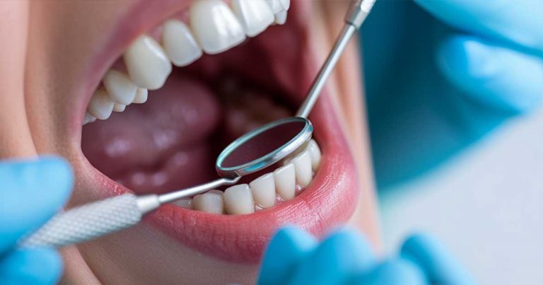 How to cure gum disease without a dentist